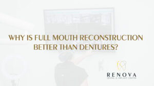 Why Is Full Mouth Reconstruction Better Than Dentures rev